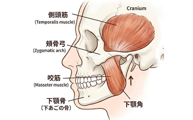 顎関節症のボトックス治療